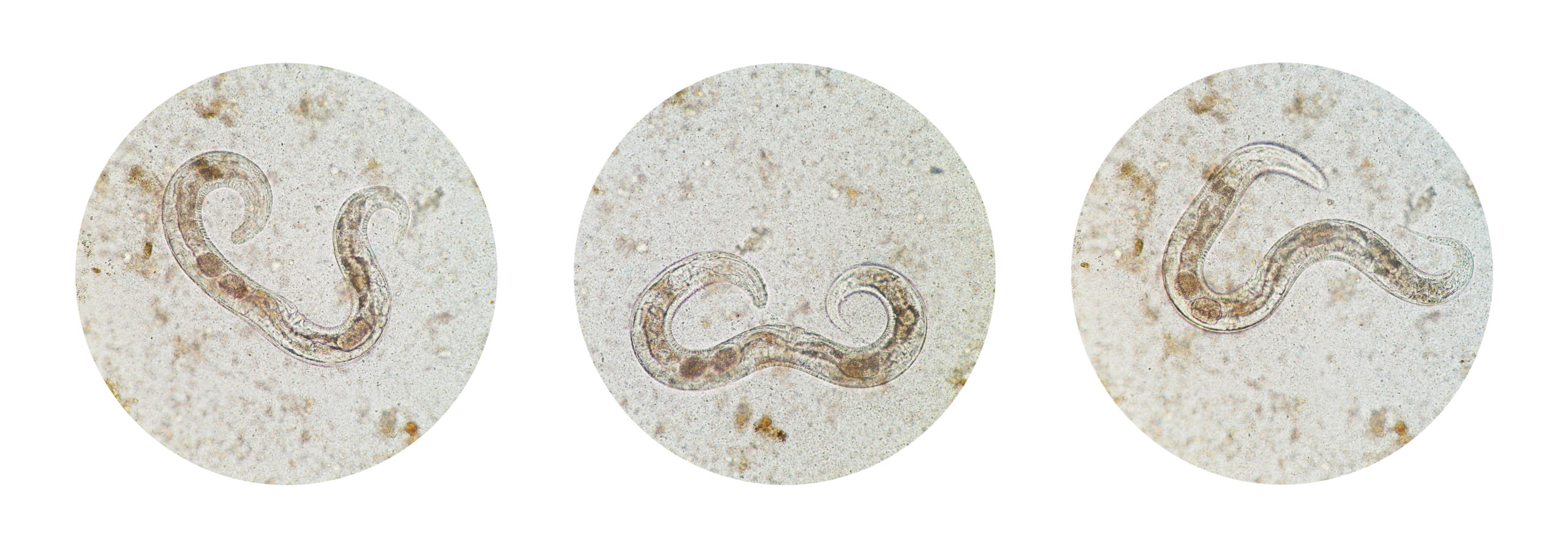 Microscopic,View,Collection,Of,Adult,Free-living,Female,Strongyloides,Stercoralis,,A